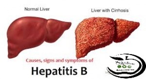 بهداشتیها-تراکت هپاتیت B