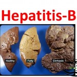 بهداشتیها-تراکت هپاتیت B