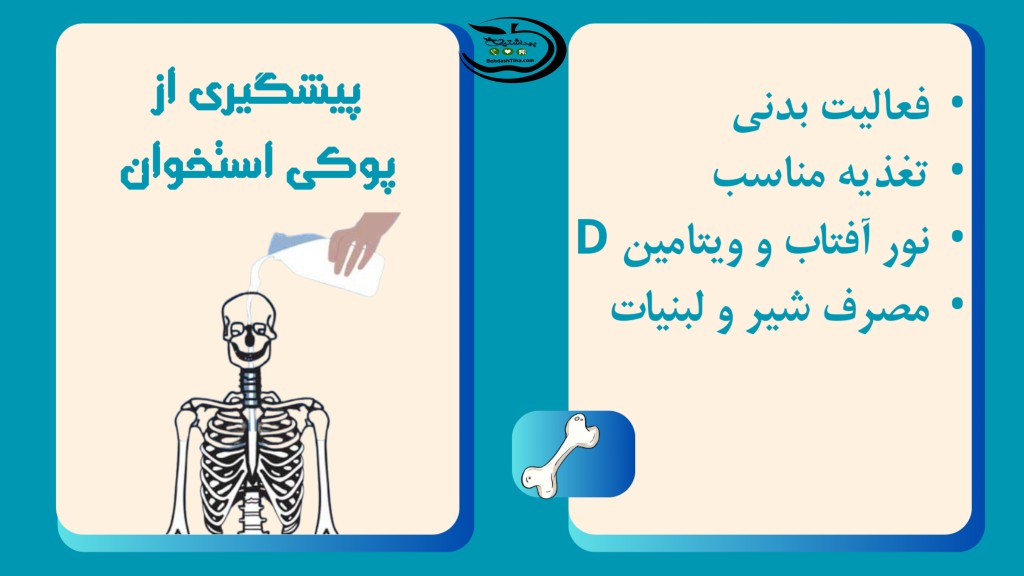 پوستر پوکی استخوان (3)